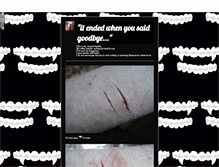 Tablet Screenshot of my-little-self-harm.tumblr.com